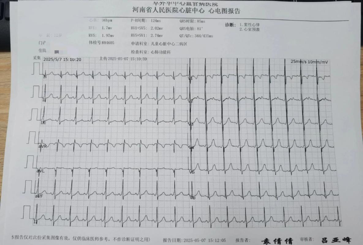 心电图中的四条线分别表示什么?