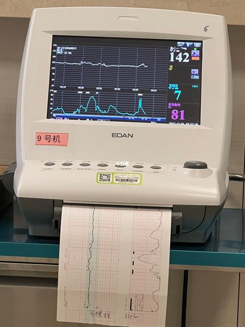 有必要买个胎心仪自己听胎心吗?
