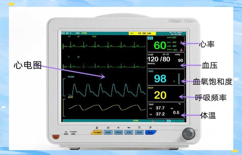常见医用心电图设备的分类及应用场景 常见医用心电图设备的分类及应用场景