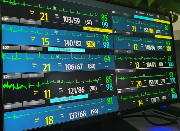 有什么胎心监护仪品牌推荐吗?