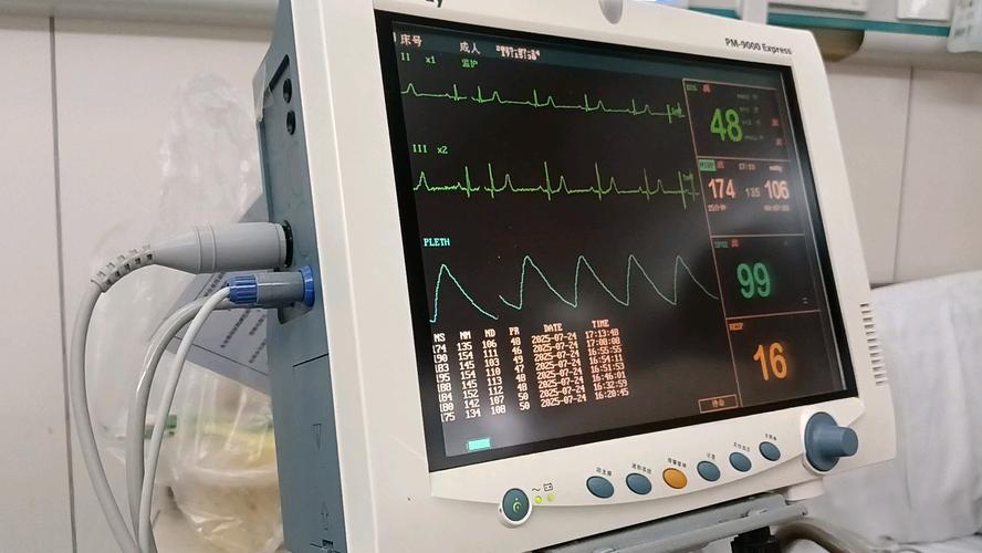 心电监护仪导联线的五个颜色分别在身上的哪几个部位?黑白棕红绿_百度知 ...