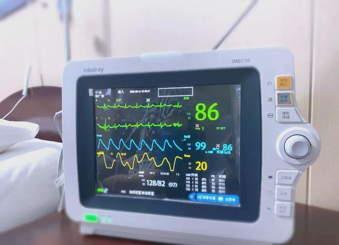 心电监护仪的小秘密 心电监护仪的小秘密