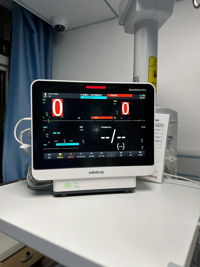 心电监测仪四根线分别表示什么 心电监测仪四根线分别表示什么