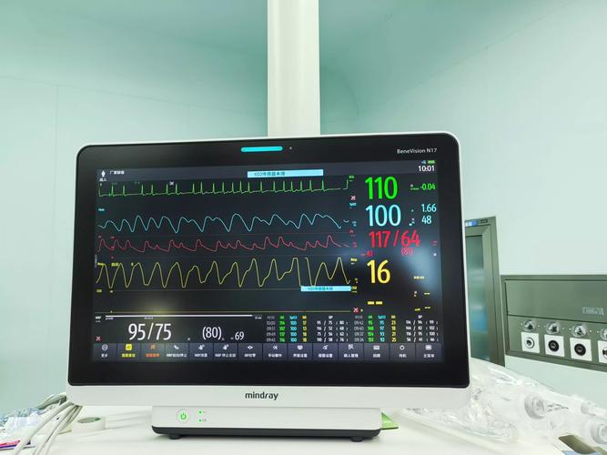 心电监护hr是什么意思