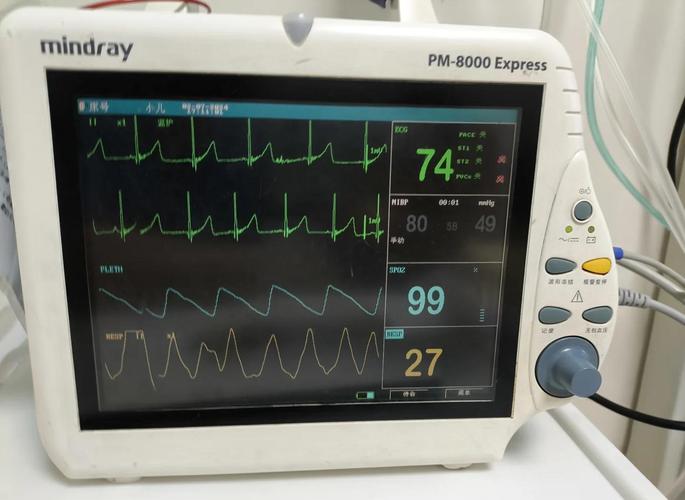 心电监护5个电极贴法 心电监护仪的电极安放位置注意事项