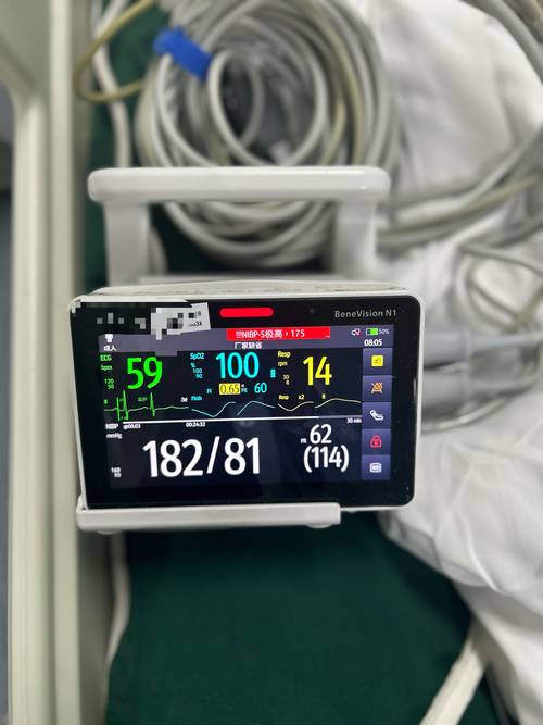 心电监护仪上ECG、 NIBP、 BP、 HR、 PR等指的是什么? 心电监护仪上ECG、 NIBP、 BP、 HR、 PR等指的是什么?