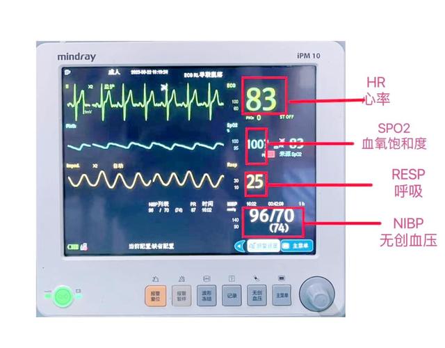 一台心电监护仪多少钱?? 一台心电监护仪多少钱??