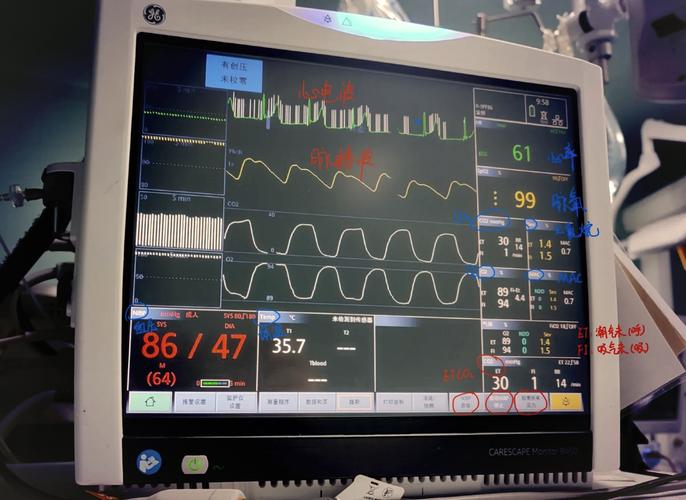 接心电监护仪,这些问题要注意 接心电监护仪,这些问题要注意