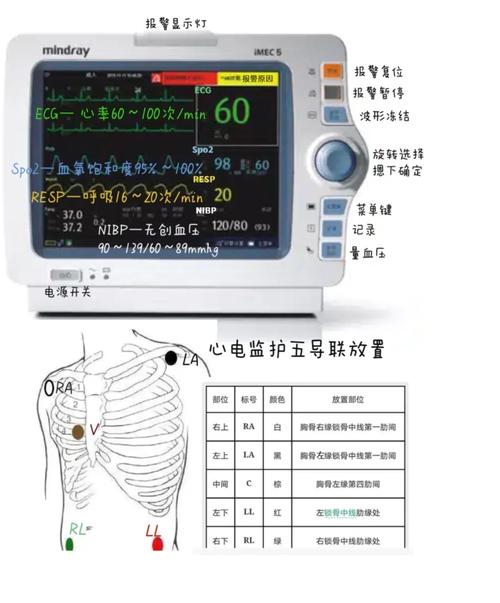 护理团建,你不知道的五个阶段