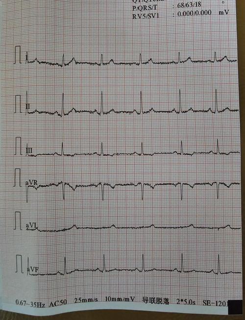怎样用美图秀秀制作带有心电图的头像