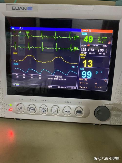 心电监护5个电极贴法 心电监护仪的电极安放位置注意事项 心电监护5个电极贴法 心电监护仪的电极安放位置注意事项